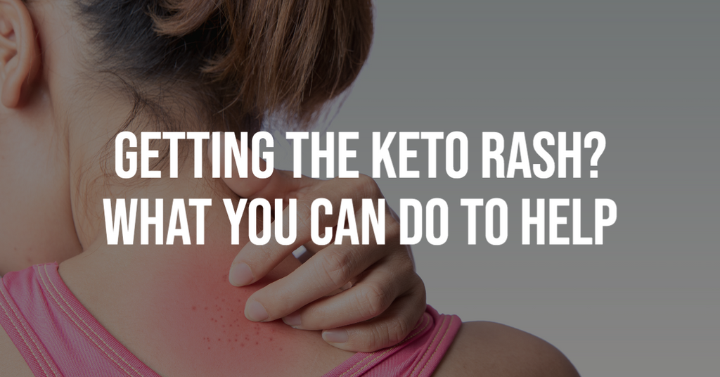 Getting the Keto Rash? What You Can Do to Help