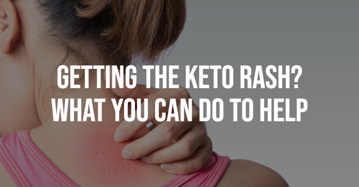 Getting the Keto Rash? What You Can Do to Help – Giant Sports International